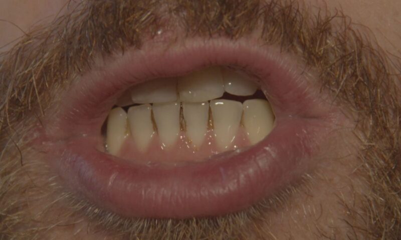 kod momka prikazana upala desni