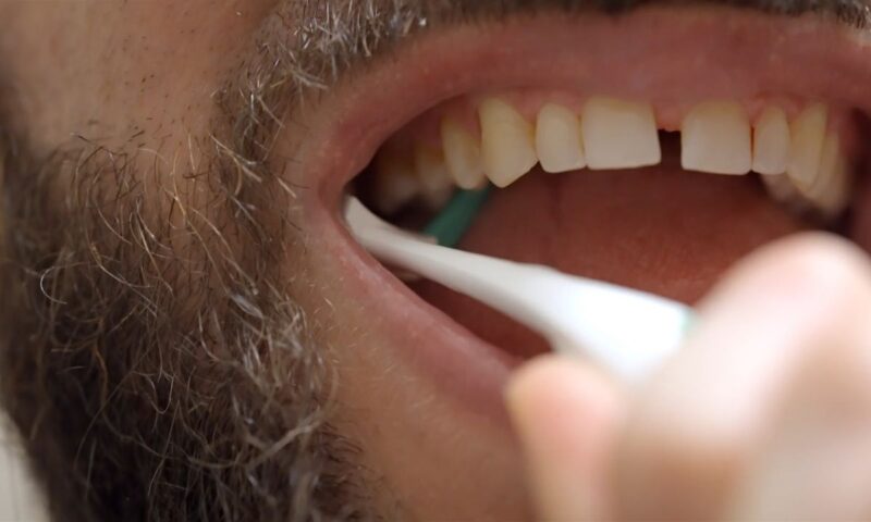 momak čisti zube sa intrerdentalnom četkicom