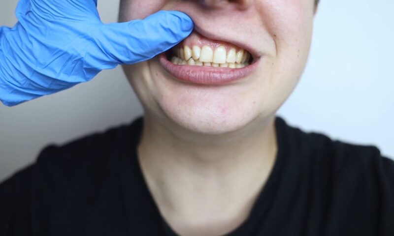 devojka pokazuje zube i desne kod zubara